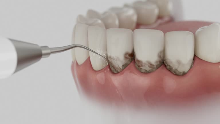 Reliable Teeth Cleaning And Checkup contractor in Wilcox County County, GA by Dentist Open Now